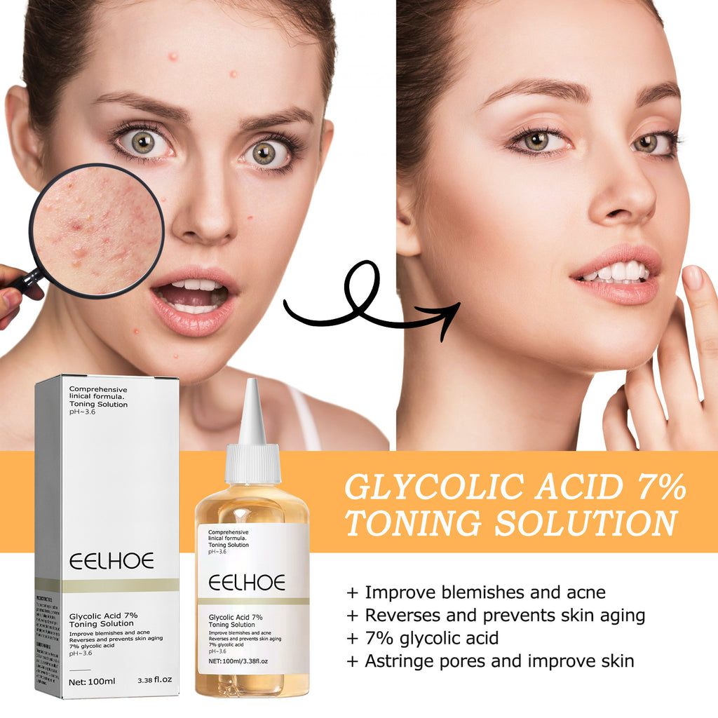 Glycolic Acid 7 Lotion Acne Remover