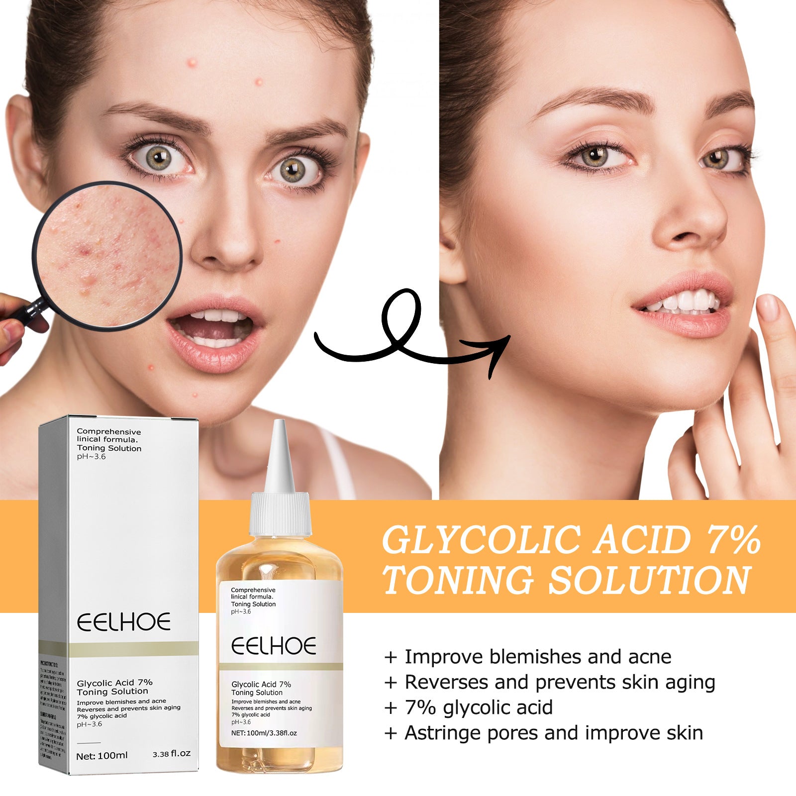 Glycolic Acid 7 Lotion Acne Remover