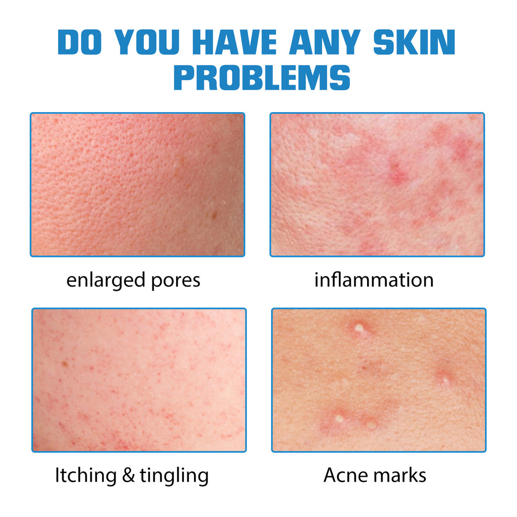 Hyaluronic Acid Replenishment Serum