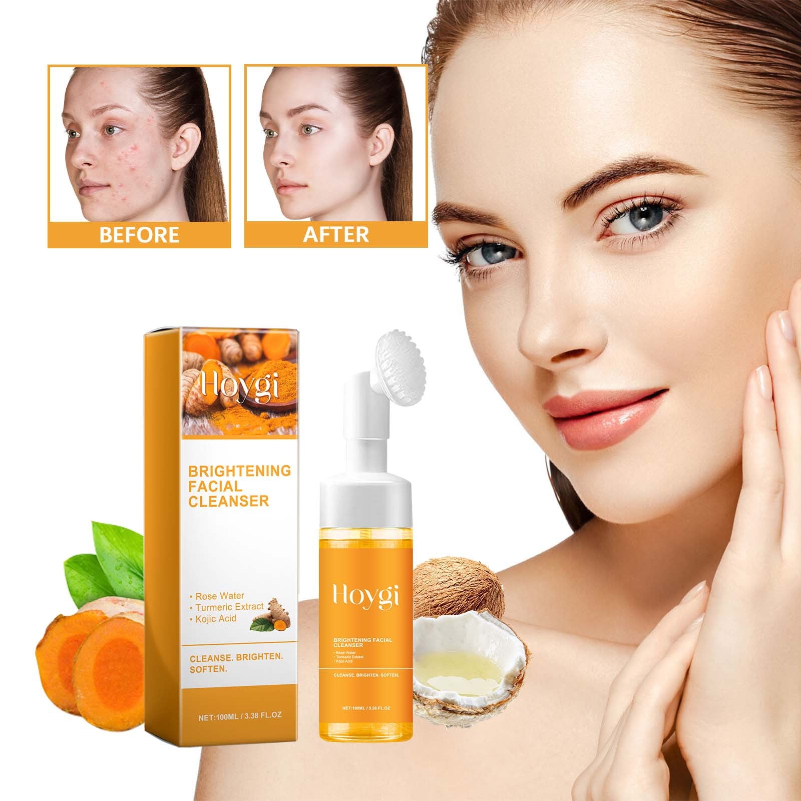 Anti Acne Turmeric Facial Cleanser