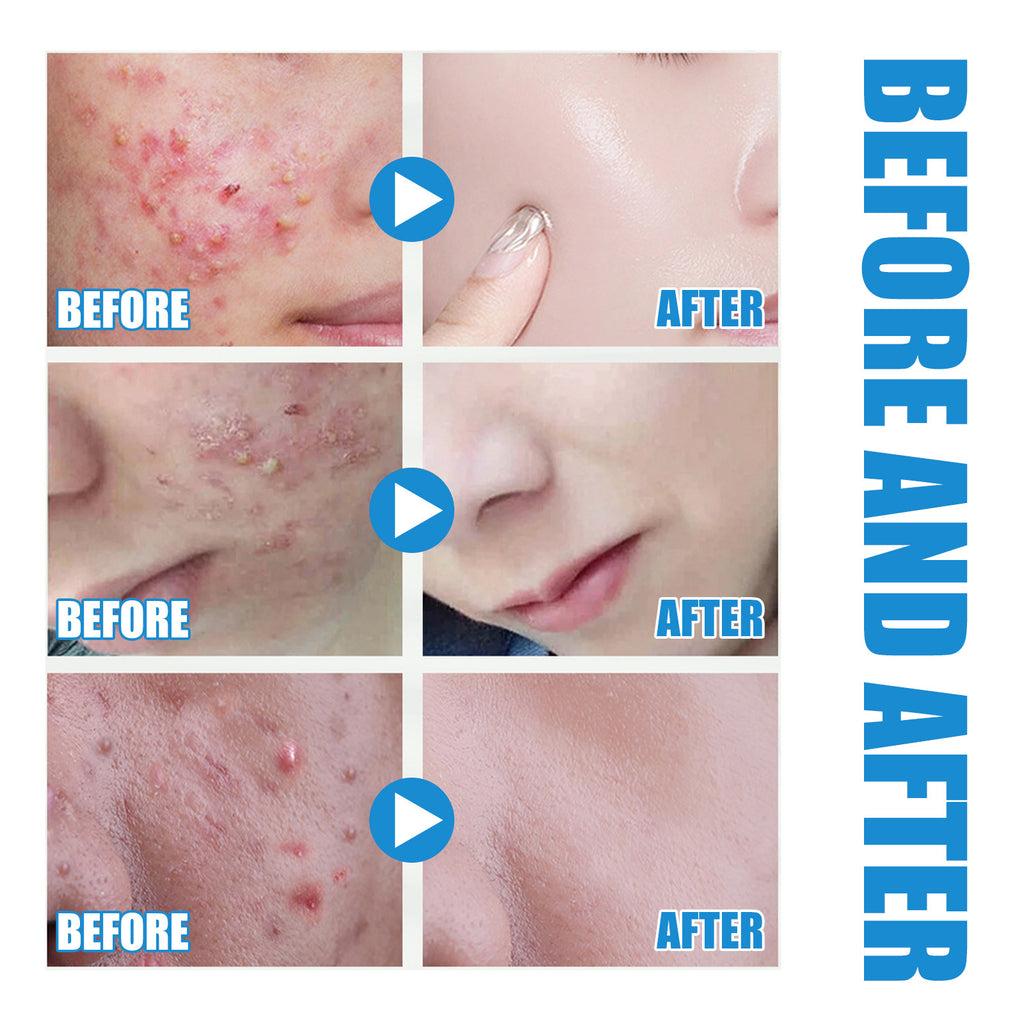 Hyaluronic Acid Replenishment Serum