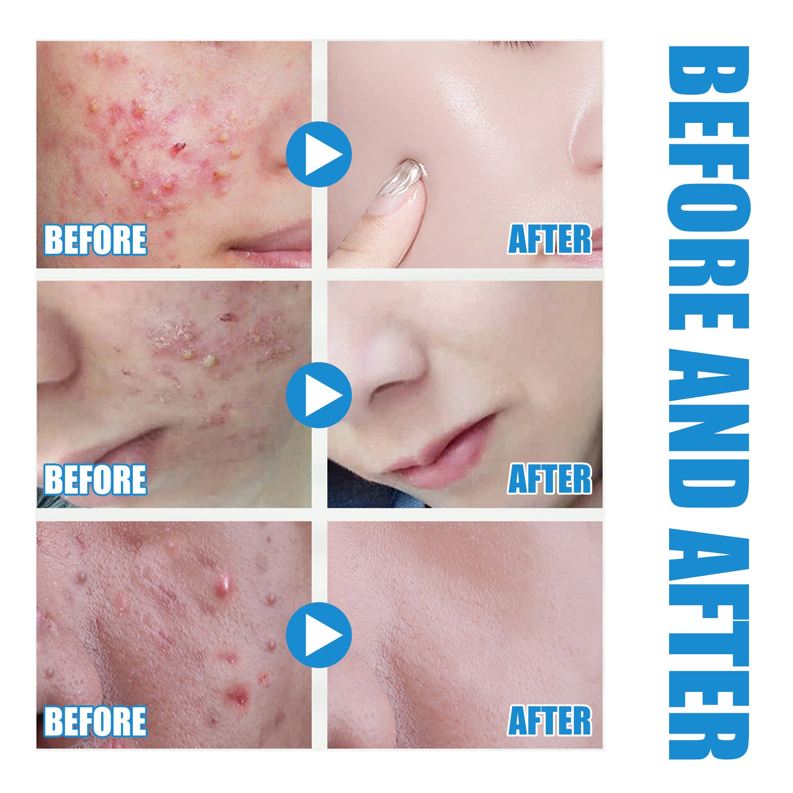 Hyaluronic Acid Replenishment Serum