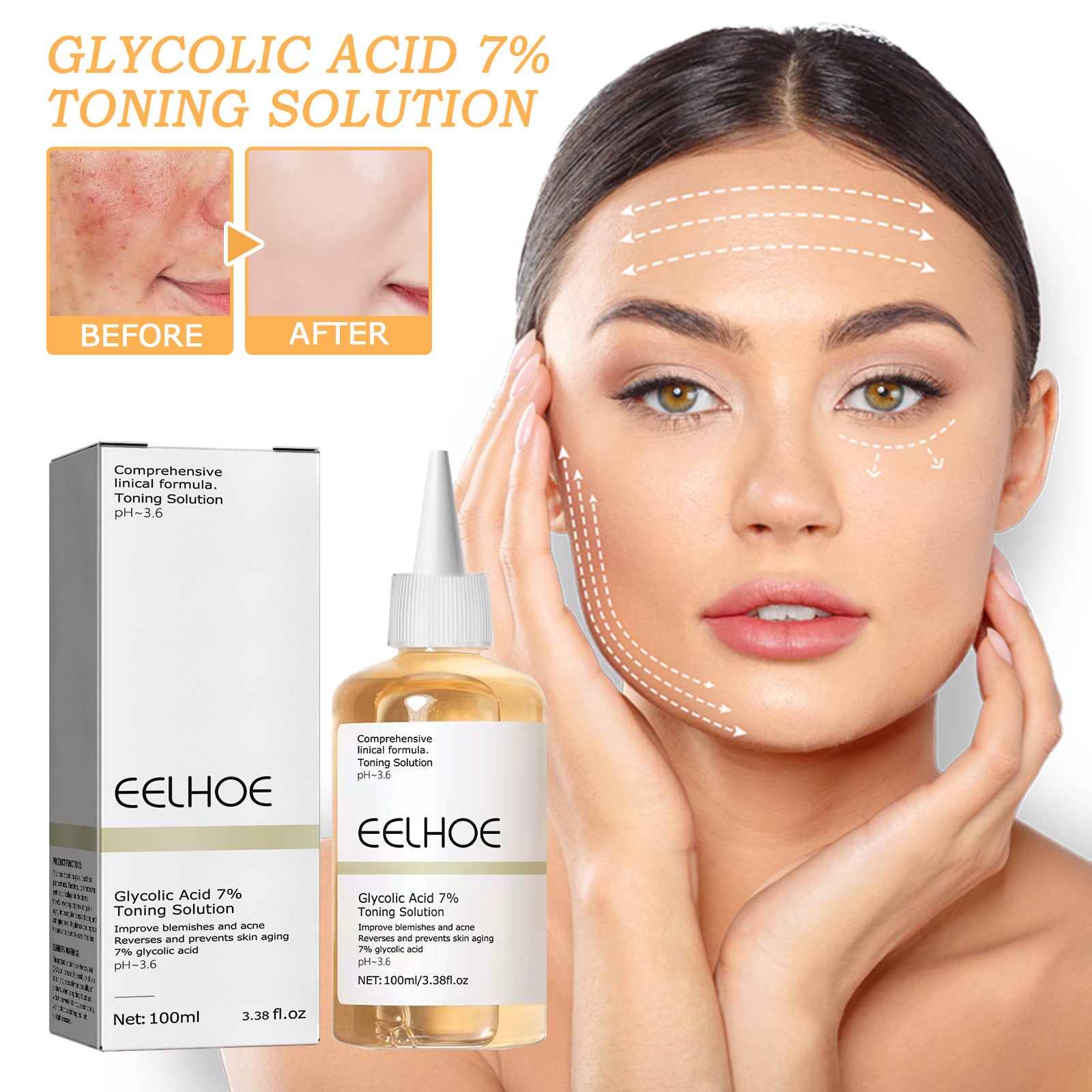 Glycolic Acid 7 Lotion Acne Remover