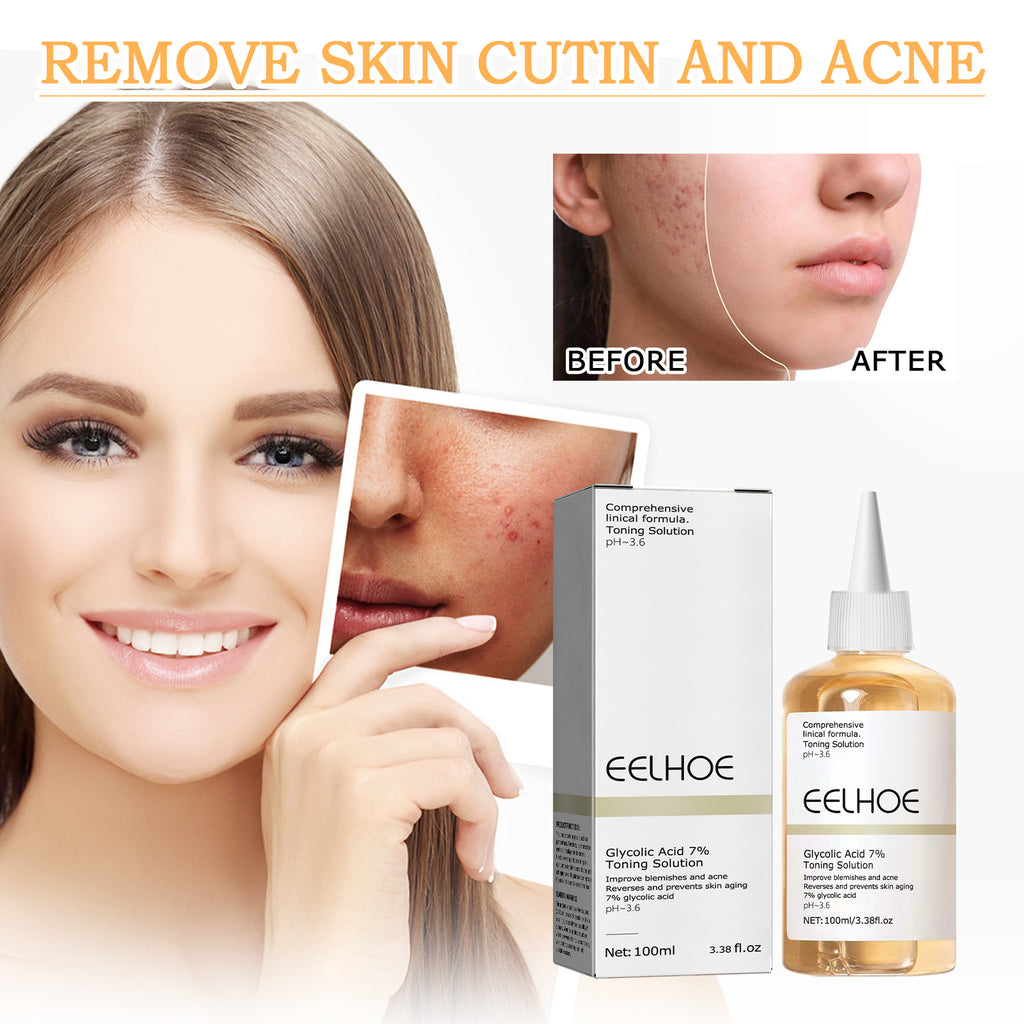 Glycolic Acid 7 Lotion Acne Remover
